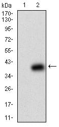 Figure 2: Western blot analysis using B2M mAb against HEK293 (1) and B2M (AA: 21-100)-hIgGFc transfected HEK293 (2) cell lysate.