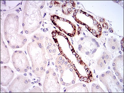 Figure 5: Immunohistochemical analysis of paraffin-embedded kidney tissues using TIE1 mouse mAb with DAB staining.