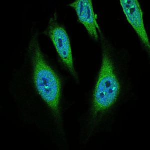 Figure 4: Immunofluorescence analysis of Hela cells using CD68 mouse mAb (green). Blue: DRAQ5 fluorescent DNA dye.