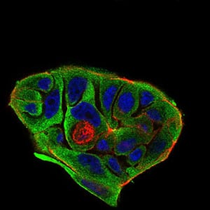 Figure 4: Immunofluorescence analysis of MCF-7 cells using BACE1 mouse mAb (green). Blue: DRAQ5 fluorescent DNA dye. Red: Actin filaments have been labeled with Alexa Fluor-555 phalloidin. Secondary antibody from Fisher (Cat#: 35503)