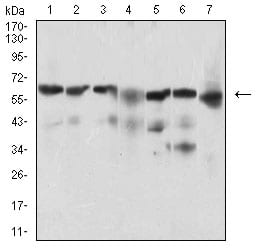 Figure 3: Western blot analysis using BACE1 mouse mAb against Hela (1), SK-N-SH (2), HepG2 (3), C6 (4), PC-12 (5), PANC-1 (6), NIH/3T3 (7) cell lysate.
