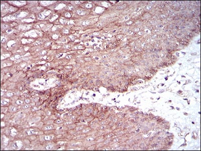 Figure 6: Immunohistochemical analysis of paraffin-embedded esophageal tissues using DSG3 mouse mAb with DAB staining.