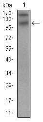 Figure 3: Western blot analysis using DSG3 mouse mAb against A431 cell lysate.