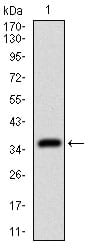 Figure 1: Western blot analysis using DSG3 mAb against human DSG3 (AA: 55-159) recombinant protein. (Expected MW is 37.5 kDa)