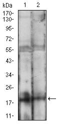 Figure 3: Western blot analysis using BAD mouse mAb against MCF-7 (1), HEK293 (2) cell lysate.