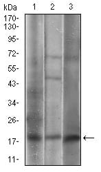 Figure 3: Western blot analysis using CAV2 mouse mAb against A549 (1), 3T3-L1 (2), A431 (3) cell lysate.