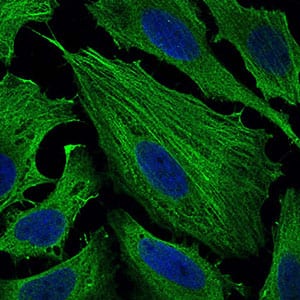 Figure 4: Immunofluorescence analysis of Hela cells using SMCP mouse mAb (green). Blue: DRAQ5 fluorescent DNA dye. Secondary antibody from Fisher (Cat#: 35503)