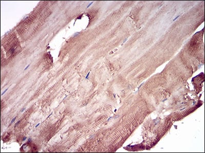 Figure 5: Immunohistochemical analysis of paraffin-embedded muscle tissues using PRL mouse mAb with DAB staining.