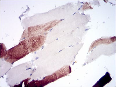 Figure 4: Immunohistochemical analysis of paraffin-embedded muscle tissues using RPTOR mouse mAb with DAB staining.