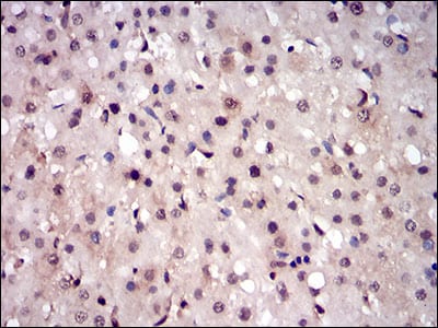 Figure 5: Immunohistochemical analysis of paraffin-embedded liver tissues using PPP1CB mouse mAb with DAB staining.