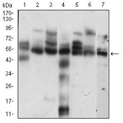 Figure 3: Western blot analysis using CCNE1 mouse mAb against Hela (1), K562 (2), NIH/3T3 (3), C6 (4), MCF-7 (5), Jurkat (6), A431 (7) cell lysate.
