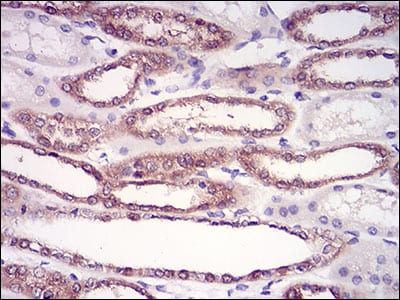 Figure 5: Immunohistochemical analysis of paraffin-embedded kidney tissues using HPRT1 mouse mAb with DAB staining.