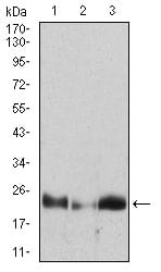 Figure 3: Western blot analysis using HPRT1 mouse mAb against Hela (1), A431 (2), A549 (3) cell lysate.