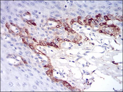 Figure 6: Immunohistochemical analysis of paraffin-embedded esophageal tissues using FTL mouse mAb with DAB staining.