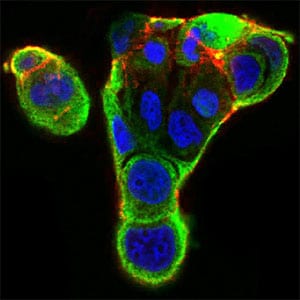 Figure 4: Immunofluorescence analysis of MCF-7 cells using XRCC6 mouse mAb (green). Blue: DRAQ5 fluorescent DNA dye. Red: Actin filaments have been labeled with Alexa Fluor-555 phalloidin. Secondary antibody from Fisher (Cat#: 35503)