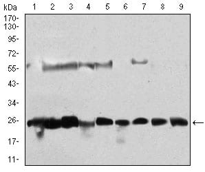 Figure 3: Western blot analysis using CSNK2B mouse mAb against Hela (1), Jurkat (2), K562 (3), HepG2 (4), C6 (5), SK-N-SH (6), NTERA-2 (7), MCF-7 (8), NIH/3T3 (9) cell lysate.