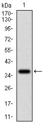 Figure 1: Western blot analysis using CD36 mAb against human CD36 (AA: 30-130) recombinant protein. (Expected MW is 37.5 kDa)