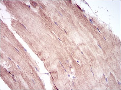 Figure 1: Immunohistochemical analysis of paraffin-embedded muscle tissues using MuRF1 mouse mAb with DAB staining.