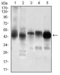 Figure 3: Western blot analysis using PDK2 mouse mAb against Jurkat (1), C6 (2), Cos7 (3), K562 (4), A431 (5) cell lysate.