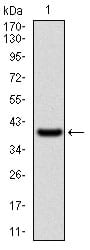 Figure 1: Western blot analysis using WAS mAb against human WAS (AA: 57-170) recombinant protein. (Expected MW is 39 kDa)