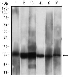 Figure 3: Western blot analysis using CSNK2B mouse mAb against Hela (1), Jurkat (2), C6 (3), MCF-7 (4), SK-N-SH (5), NTERA-2 (6) cell lysate.