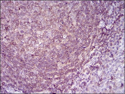 Figure 4: Immunohistochemical analysis of paraffin-embedded lymph tissues using APBB1IP mouse mAb with DAB staining.