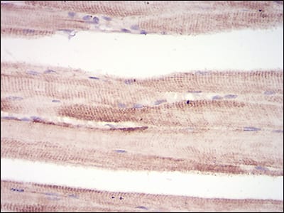 Figure 4: Immunohistochemical analysis of paraffin-embedded muscle tissues using MuRF1 mouse mAb with DAB staining.