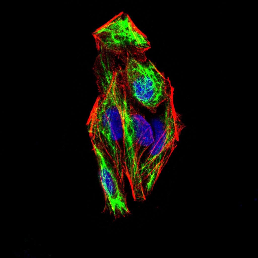 Figure 4:Immunofluorescence analysis of Hela cells using SNAI2 mouse mAb (green). Blue: DRAQ5 fluorescent DNA dye. Red: Actin filaments have been labeled with Alexa Fluor- 555 phalloidin. Secondary antibody from Fisher (Cat#: 35503)