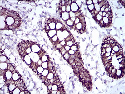 Figure 4: Immunohistochemical analysis of paraffin-embedded colon tissues using CDH17 mouse mAb with DAB staining.