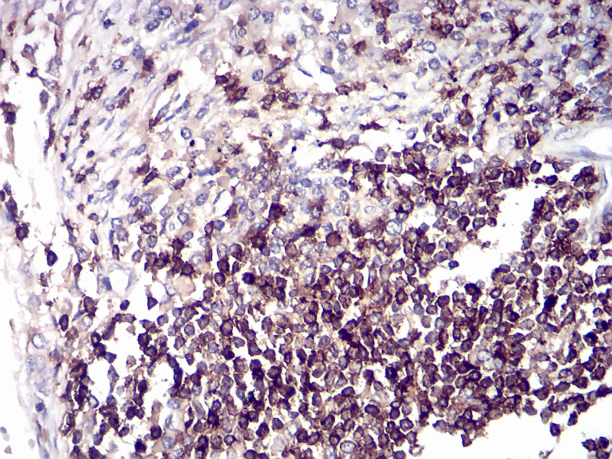 Figure 5: Immunohistochemical analysis of paraffin-embedded tissues using breast cancer mouse mAb with DAB staining.