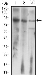Figure 2: Western blot analysis using LHCGR mouse mAb against HepG2 (1), Jurkat (2), and SMMC-7721 (3) cell lysate.