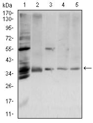 Figure 4:Western blot analysis using ANXA5 mouse mAb against PANC-1 (1), Hela (2), A431 (3), A549 (4) and MCF-7 (5) cell lysate.