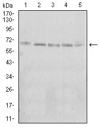 Figure 4:Western blot analysis using KBTBD8 mouse mAb against A431 (1), Jurkat (2), Hela (3), K562 (4), and HEK293 (5) cell lysate.