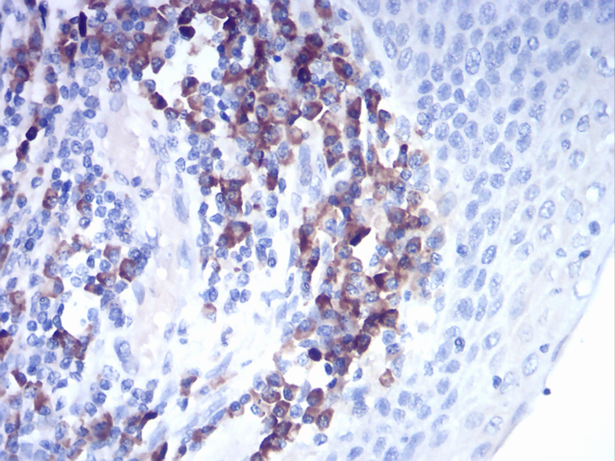 Figure 3:Immunohistochemical analysis of paraffin-embedded esophagus tissues using CTSD mouse mAb with DAB staining.