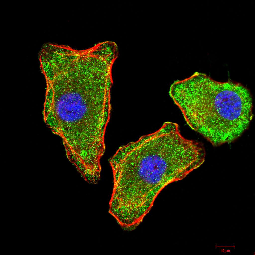 Figure 5:Immunofluorescence analysis of MCF-7 cells using TTR mouse mAb (green). Blue: DRAQ5 fluorescent DNA dye. Red: Actin filaments have been labeled with Alexa Fluor- 555 phalloidin. Secondary antibody from Fisher (Cat#: 35503)