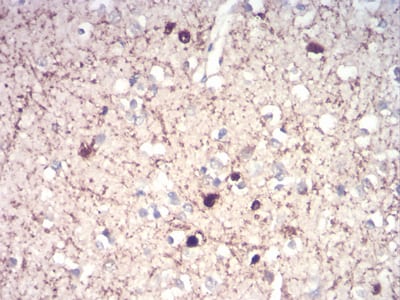 Figure 5:Immunohistochemical analysis of paraffin-embedded brain tissues using CALB2 mouse mAb with DAB staining.