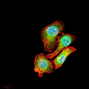 Figure 5:Immunofluorescence analysis of MCF-7 cells using AIM2 mouse mAb (green). Blue: DRAQ5 fluorescent DNA dye. Red: Actin filaments have been labeled with Alexa Fluor- 555 phalloidin. Secondary antibody from Fisher (Cat#: 35503)