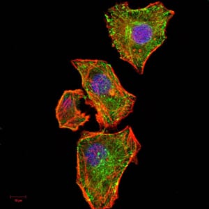 Figure 5:Immunofluorescence analysis of MCF-7 cells using NFKBIA mouse mAb (green). Blue: DRAQ5 fluorescent DNA dye. Red: Actin filaments have been labeled with Alexa Fluor- 555 phalloidin. Secondary antibody from Fisher (Cat#: 35503)