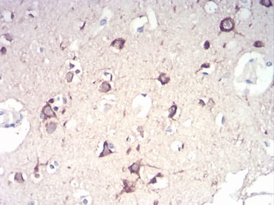 Figure 8:Immunohistochemical analysis of paraffin-embedded brain tissues using NFKBIA mouse mAb with DAB staining.