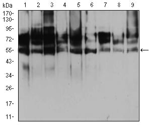 Figure 4:Western blot analysis using HDAC2 mouse mAb against Hela (1), Jurat (2), HepG2 (3), Hek293 (4), K562 (5), MCF-7 (6), NIH3T3 (7), COS7 (8) and PC-12 (9) cell lysate.