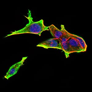 Figure 4:Immunofluorescence analysis of Hela cells using Rab13 mouse mAb (green). Blue: DRAQ5 fluorescent DNA dye. Red: Actin filaments have been labeled with Alexa Fluor- 555 phalloidin. Secondary antibody from Fisher (Cat#: 35503)