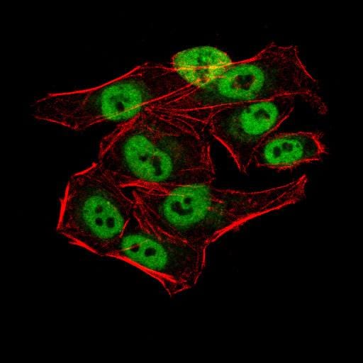 Figure 5:Immunofluorescence analysis of HeLa cells using AOF1 mouse mAb (green). Blue: DRAQ5 fluorescent DNA dye. Red: Actin filaments have been labeled with Alexa Fluor- 555 phalloidin. Secondary antibody from Fisher (Cat#: 35503)