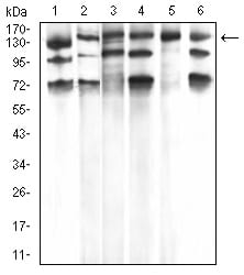Figure 4:Western blot analysis using PLCG1 mouse mAb against Hela (1), A431 (2), C6 (3), NIH/3T3 (4), COS7 (5), and HCT116 (6) cell lysate.