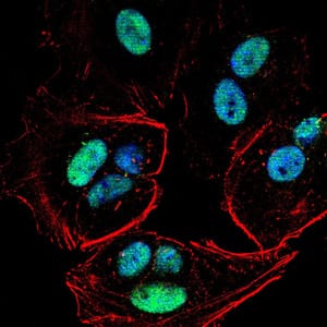 Figure 5:Immunofluorescence analysis of MCF-7 cells using PMS2 mouse mAb (green). Blue: DRAQ5 fluorescent DNA dye. Red: Actin filaments have been labeled with Alexa Fluor- 555 phalloidin. Secondary antibody from Fisher (Cat#: 35503)