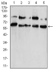 Figure 4:Western blot analysis using CBX2 mouse mAb against HUVEC (1), HEK293 (2), Hela (3), NIH/3T3 (4), and A431 (5) cell lysate.