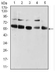 Figure 4:Western blot analysis using CBX2 mouse mAb against HUVEC (1), HEK293 (2), Hela (3), NIH/3T3 (4), and A431 (5) cell lysate.