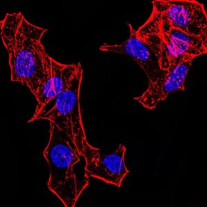 Figure 2:Immunofluorescence analysis of HeLa cells. Blue: DRAQ5 fluorescent DNA dye. Red: Actin filaments have been labeled with Alexa Fluor- 555 phalloidin.