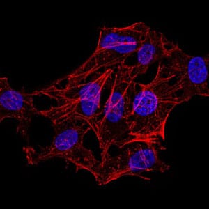 Figure 2:Immunofluorescence analysis of HeLa cells . Blue: DRAQ5 fluorescent DNA dye. Red: Actin filaments have been labeled with Alexa Fluor- 555 phalloidin.