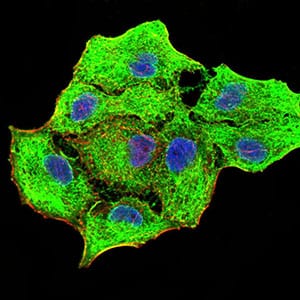 Figure 5:Immunofluorescence analysis of MCF-7 cells using CK5 mouse mAb (green). Blue: DRAQ5 fluorescent DNA dye. Red: Actin filaments have been labeled with Alexa Fluor- 555 phalloidin. Secondary antibody from Fisher (Cat#: 35503)