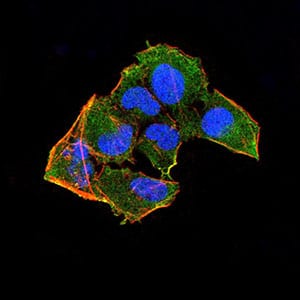 Figure 5:Immunofluorescence analysis of HeLa cells using RAD52 mouse mAb (green). Blue: DRAQ5 fluorescent DNA dye. Red: Actin filaments have been labeled with Alexa Fluor- 555 phalloidin. Secondary antibody from Fisher (Cat#: 35503)